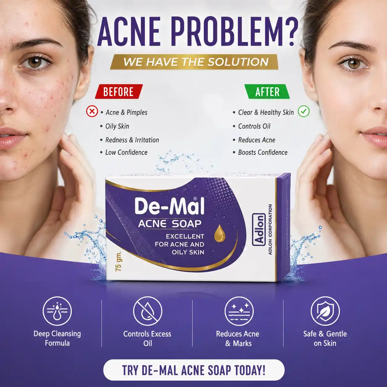 De-Mal Acne Soap | Deep Cleansing Bar for Acne Prone Skin