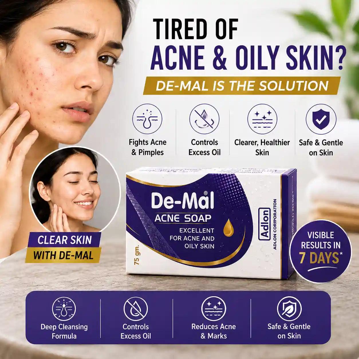 De-Mal Acne Soap | Deep Cleansing Bar for Acne Prone Skin