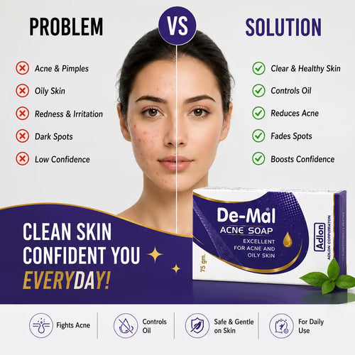 De-Mal Acne Soap | Deep Cleansing Bar for Acne Prone Skin